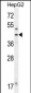 FAH Antibody (N-term)